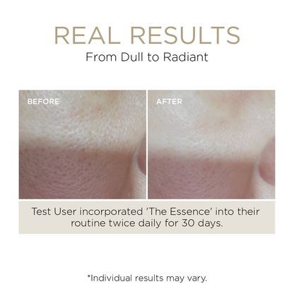 Lumière de Vie® The Essence (Hydrating Tonic)